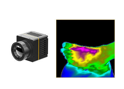Uncooled термальный модуль 384x288 17μM для Thermographic медицинского здравоохранения